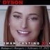 WoodmanCastingX – Dolly Dyson – Casting